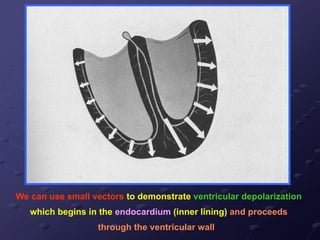 We can use small vectors to demonstrate ventricular depolarization
which begins in the endocardium (inner lining) and proceeds
through the ventricular wall
 