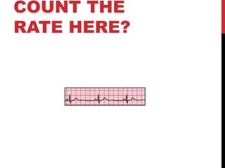 COUNT THE
RATE HERE?
 