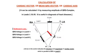 normal ecg dr rashmi.pptx