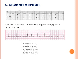 Normal Electrocardiogram Measurements.ppt