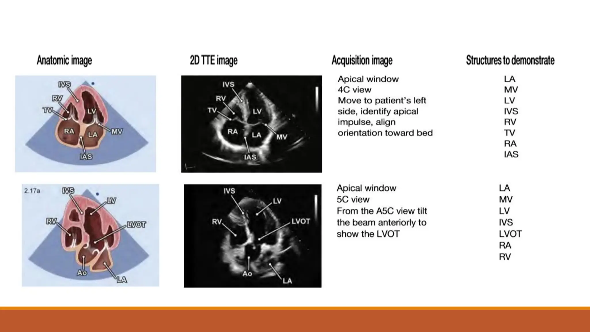 Normal Echocardiogram. Based on cardiac studies