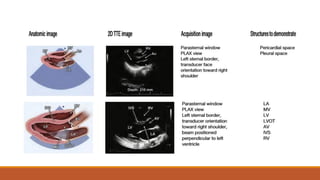 Normal Rabbit Echo Normal Echocardiogram. Based on cardiac studies | PDF