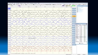 Regular Eeg Waveforms Normal EEG waveforms.pptx