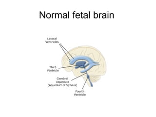 Normal fetal brain  