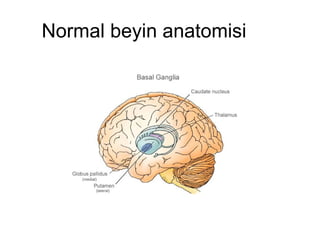 Normal beyin anatomisi 