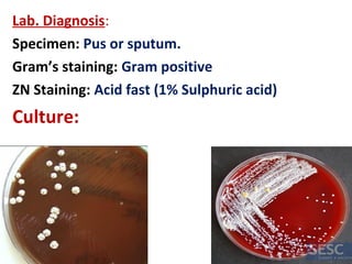 Lab. Diagnosis:
Specimen: Pus or sputum.
Gram’s staining: Gram positive
ZN Staining: Acid fast (1% Sulphuric acid)
Culture:
 