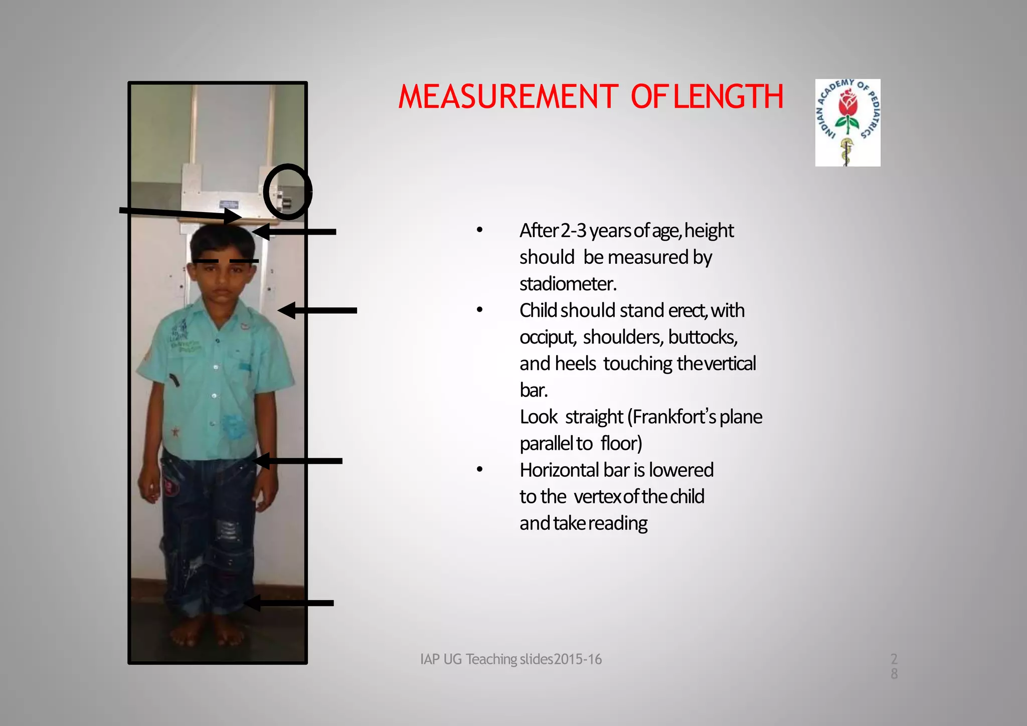 MEASUREMENT OFLENGTH
• After2‐3yearsofage,height
should bemeasuredby
stadiometer.
• Childshouldstanderect,with
occiput, shoulders,buttocks,
andheels touching thevertical
bar.
Look straight(Frankfort’splane
parallelto floor)
• Horizontalbarislowered
tothe vertexofthechild
andtakereading
IAP UG Teaching slides2015‐16 2
8
 