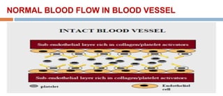 NORMAL BLOOD FLOW IN BLOOD VESSEL
 