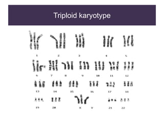 Triploid karyotype
 