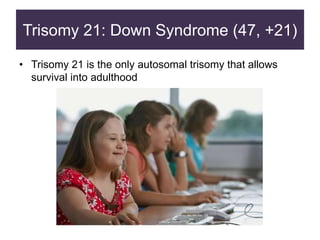Trisomy 21: Down Syndrome (47, +21)
• Trisomy 21 is the only autosomal trisomy that allows
survival into adulthood
 