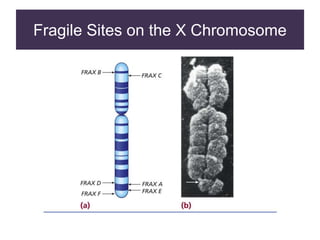 Fragile Sites on the X Chromosome
 