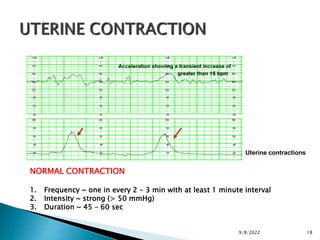 Normal Contraction normal laboor & delivery.pptxi | PPTX
