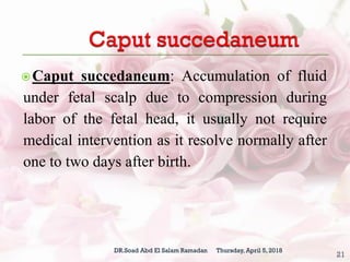 (Normal labor) .ppt