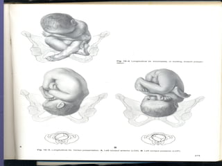 Normal Labor And Delivery | PPT