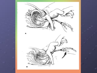 Normal Labor And Delivery | PPT