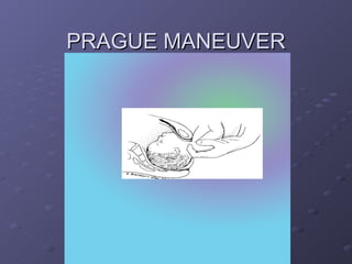 PRAGUE MANEUVER 