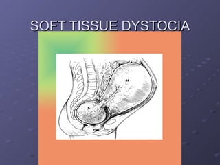 SOFT TISSUE DYSTOCIA 