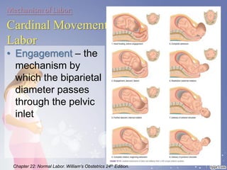 Mechanism of Labor:
Cardinal Movements of
Labor
• Engagement – the
mechanism by
which the biparietal
diameter passes
through the pelvic
inlet
Chapter 22: Normal Labor. William’s Obstetrics 24th Edition.
 