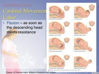 Mechanism of Labor:
Cardinal Movements of
Labor
• Flexion – as soon as
the descending head
meets resistance
Chapter 22: Normal Labor. William’s Obstetrics 24th Edition.
 