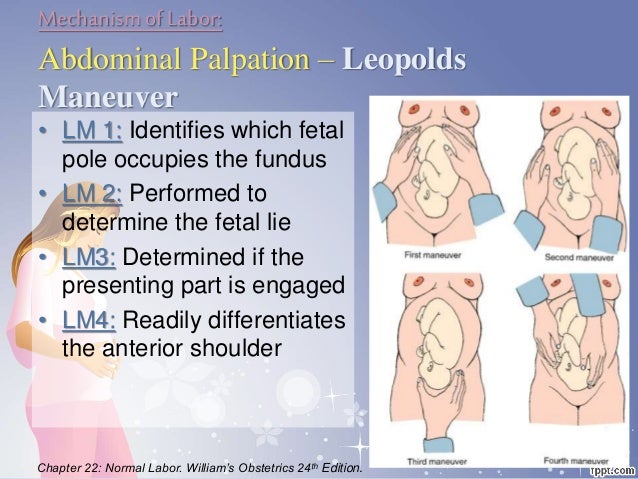 leopold maneuver