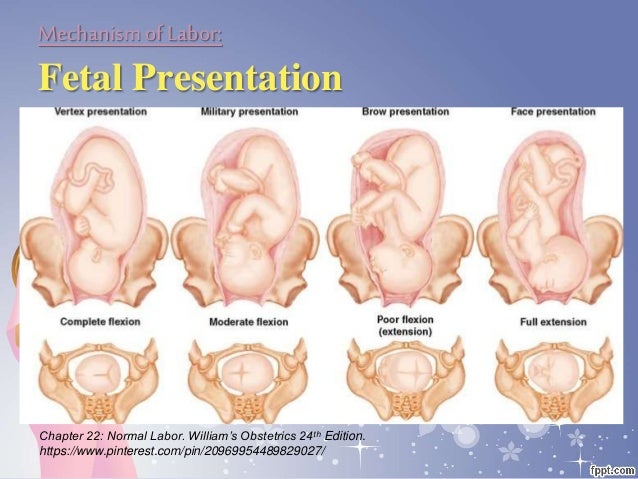 normal presentation of the fetus