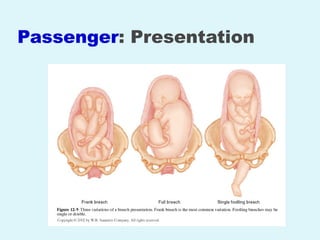 Normal Labor and Delivery. Seminar presentationpptx | PPTX