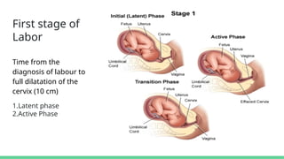 Normal Labor with all stages and complete management | PPTX