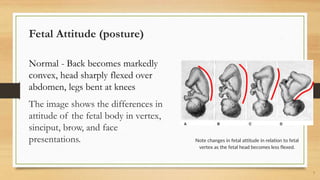 Sandifer Position NORMAL LABOR AND DELIVERY | PPTX