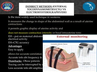 NORMAL LABOR, parturition|progress and stages of labor | PPT