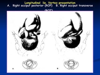 Normal labor paramedics | PPT