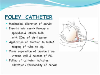 FOLEY  CATHETER Mechanical  dilatation  of  cervix. Inserts  into  cervix through a  speculum &  inflate  bulb  with  20ml  of  distil water. Application  of  traction  to  bulb &  tapping  of  tube  to  leg. Cause  separation  of  amnion  from  uterine  wall  &  release  of  PG. Falling  of  catheter  indicates  dilatation / favorability  of  cervix .  