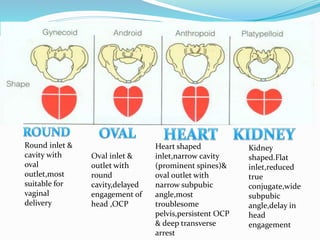 Round inlet &
cavity with
oval
outlet,most
suitable for
vaginal
delivery
Oval inlet &
outlet with
round
cavity,delayed
engagement of
head ,OCP
Heart shaped
inlet,narrow cavity
(prominent spines)&
oval outlet with
narrow subpubic
angle,most
troublesome
pelvis,persistent OCP
& deep transverse
arrest
Kidney
shaped.Flat
inlet,reduced
true
conjugate,wide
subpubic
angle,delay in
head
engagement
 