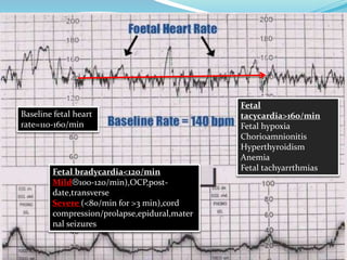 Baseline fetal heart
rate=110-160/min
Fetal
tacycardia>160/min
Fetal hypoxia
Chorioamnionitis
Hyperthyroidism
Anemia
Fetal tachyarrthmiasFetal bradycardia<120/min
Mild100-120/min),OCP,post-
date,transverse
Severe (<80/min for >3 min),cord
compression/prolapse,epidural,mater
nal seizures
 