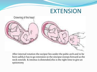 EXTENSION
After internal rotation the occiput lies under the pubic arch and to be
born safely,it has to go extension so the sinciput sweeps forward as the
neck extends & intoitus is distended,this is the right time to give an
episiotomy
 