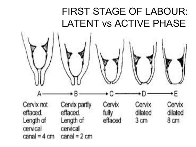 Normal labour Normal labour