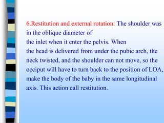 6.Restitution and external rotation: The shoulder was
in the oblique diameter of
the inlet when it enter the pelvis. When
the head is delivered from under the pubic arch, the
neck twisted, and the shoulder can not move, so the
occiput will have to turn back to the position of LOA,
make the body of the baby in the same longitudinal
axis. This action call restitution.
 