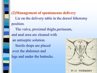 (2)Management of spontaneous delivery
Lie on the delivery table in the dorsol lithotomy
position.
The vulva, proximal thighs,perineum,
and anal area are cleaned with
an antiseptic solution.
Sterile draps are placed
over the abdomen and
legs and under the buttocks.
 