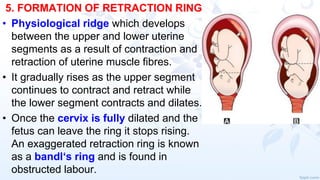 5. FORMATION OF RETRACTION RING
• Physiological ridge which develops
between the upper and lower uterine
segments as a result of contraction and
retraction of uterine muscle fibres.
• It gradually rises as the upper segment
continues to contract and retract while
the lower segment contracts and dilates.
• Once the cervix is fully dilated and the
fetus can leave the ring it stops rising.
An exaggerated retraction ring is known
as a bandl‘s ring and is found in
obstructed labour.
 