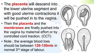 • The placenta will descend into
the lower uterine segment and
with good uterine contractions it
will be pushed in to the vagina.
• Then the placenta and the
membranes are finally pushed into
the vagina by maternal effort or by
controlled cord traction. (CCT)
• Note ; the average blood loss
should be between 120-150mls in
normal 3rd stage of labour.
 