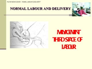 NORMAL LABOUR AND DELIVERY Prof DR MOHD AZHAR – “NOMAL LABOUR & DELIVERY” MANAGEMENT THIRD STAGE OF  LABOUR 