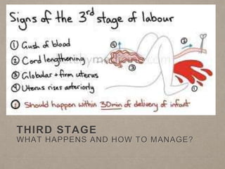 THIRD STAGE
WHAT HAPPENS AND HOW TO MANAGE?
 