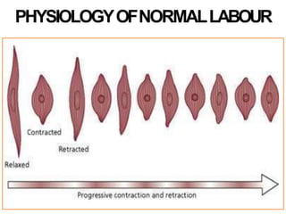 PHYSIOLOGYOFNORMALLABOUR
 