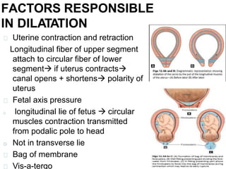 FACTORS RESPONSIBLE
IN DILATATION
Uterine contraction and retraction
Longitudinal fiber of upper segment
attach to circular fiber of lower
segment if uterus contracts
canal opens + shortens polarity of
uterus
Fetal axis pressure
o longitudinal lie of fetus  circular
muscles contraction transmitted
from podalic pole to head
o Not in transverse lie
Bag of membrane
Vis-a-tergo
 