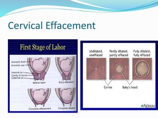 Normal labour [autosaved] | PPTX