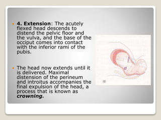  4. Extension: The acutely
flexed head descends to
distend the pelvic floor and
the vulva, and the base of the
occiput comes into contact
with the inferior rami of the
pubis.
 The head now extends until it
is delivered. Maximal
distension of the perineum
and introitus accompanies the
final expulsion of the head, a
process that is known as
crowning.
 