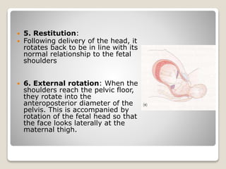  5. Restitution:
 Following delivery of the head, it
rotates back to be in line with its
normal relationship to the fetal
shoulders
 6. External rotation: When the
shoulders reach the pelvic floor,
they rotate into the
anteroposterior diameter of the
pelvis. This is accompanied by
rotation of the fetal head so that
the face looks laterally at the
maternal thigh.
 