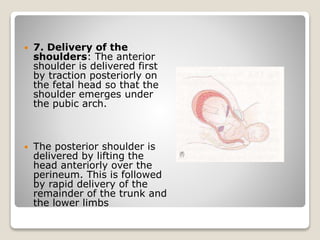  7. Delivery of the
shoulders: The anterior
shoulder is delivered first
by traction posteriorly on
the fetal head so that the
shoulder emerges under
the pubic arch.
 The posterior shoulder is
delivered by lifting the
head anteriorly over the
perineum. This is followed
by rapid delivery of the
remainder of the trunk and
the lower limbs
 