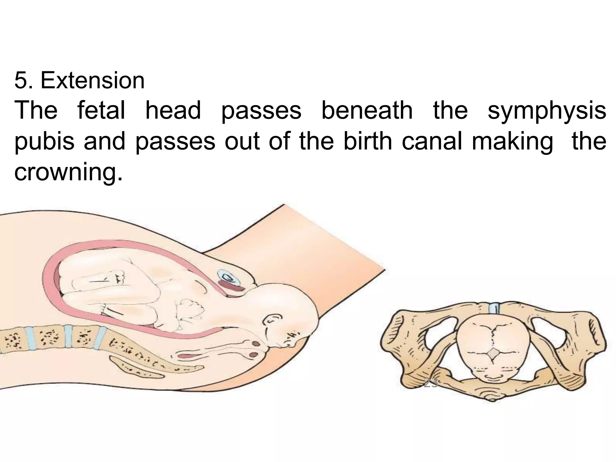 Nhs Labour Algorithm Image NORMAL LABOUR& Mechanism.pptx