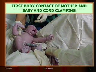 FIRST BODY CONTACT OF MOTHER AND
             BABY AND CORD CLAMPING




7/31/2012            Dr. Yin Moe Han       27
 