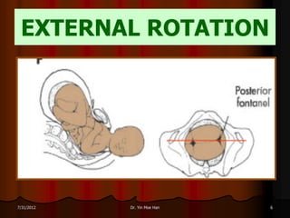 EXTERNAL ROTATION




7/31/2012   Dr. Yin Moe Han   6
 